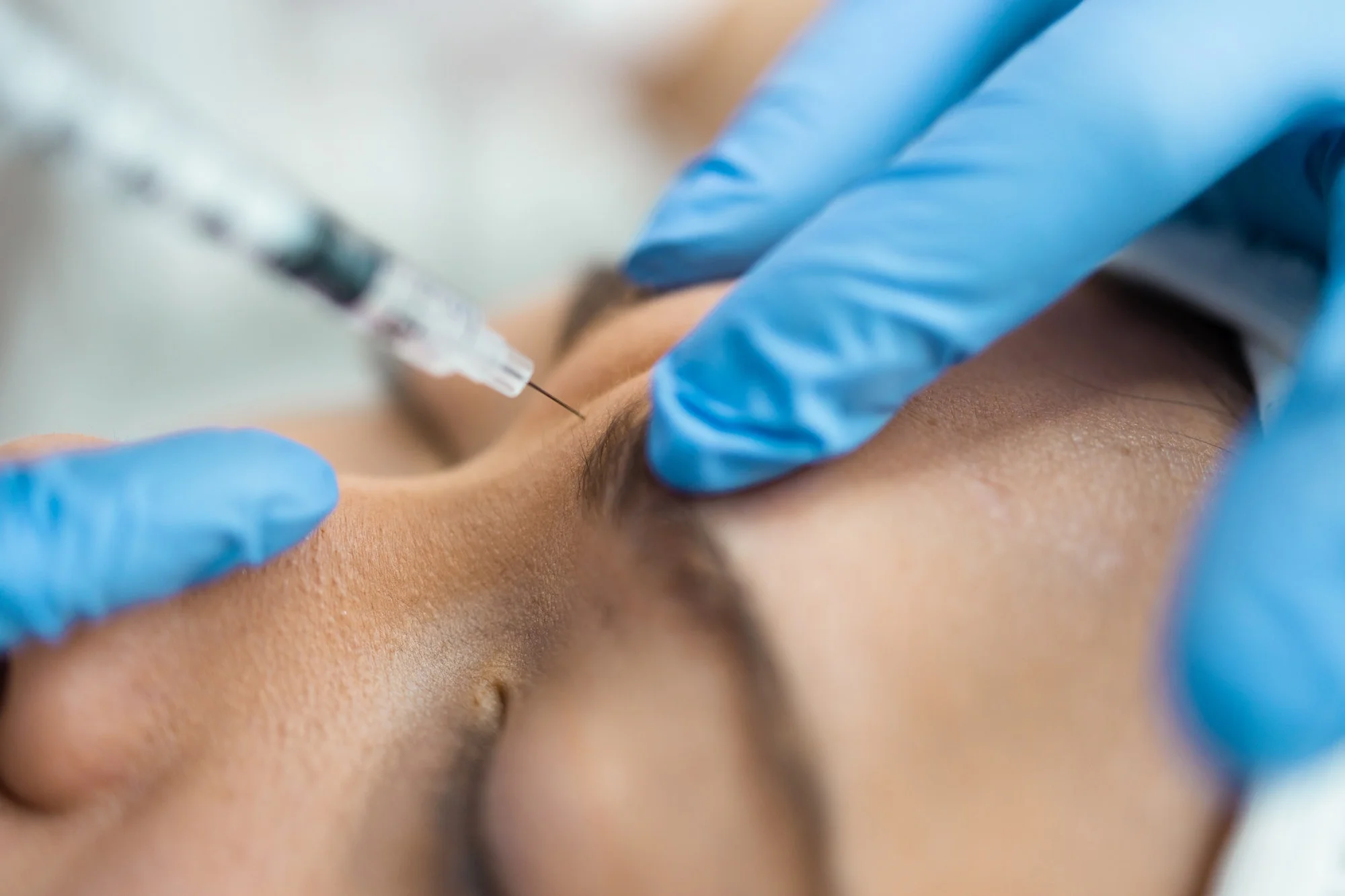 B-Tox treatment