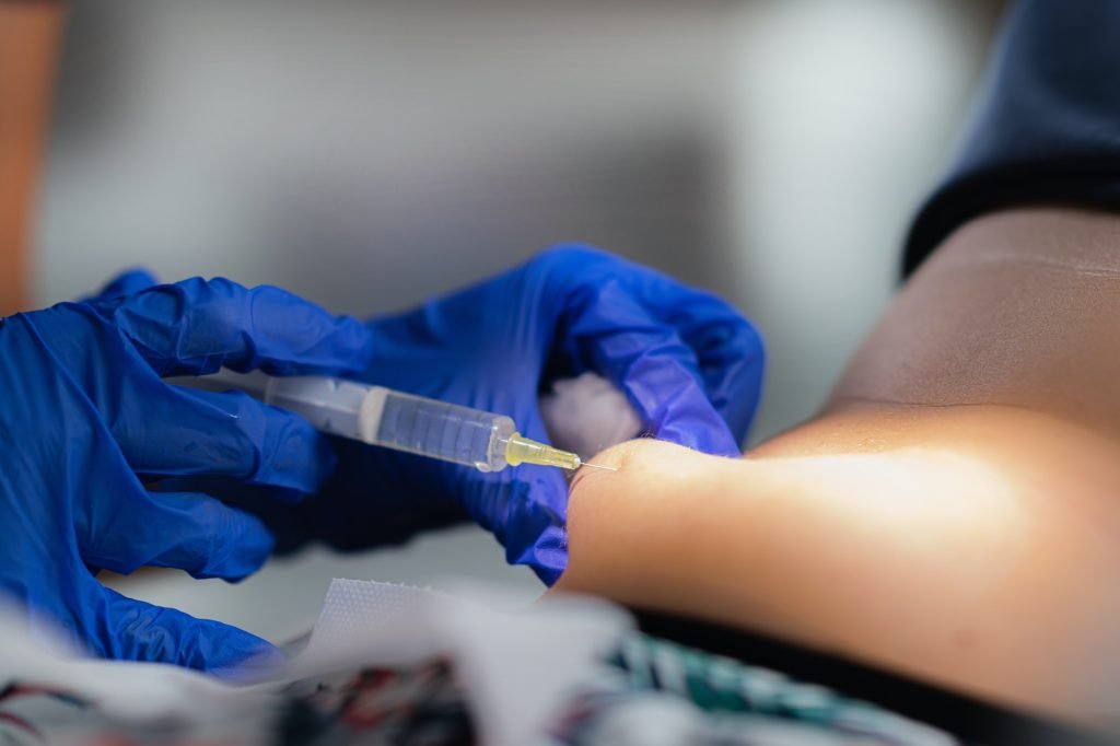 Lipolysis Treatment on the Belly Adipose Tissue